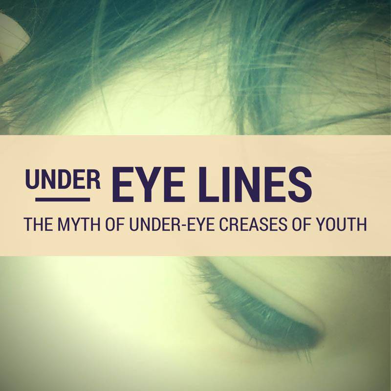 Under eye creases of youth